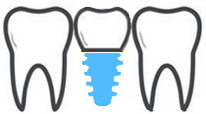 mn dental surgery